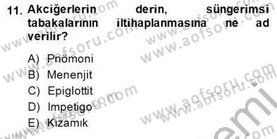 Anne Çocuk Sağlığı Ve İlkyardım Dersi 2014 - 2015 Yılı (Vize) Ara Sınav Soruları 11. Soru