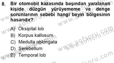 Çocuk Ruh Sağlığı Dersi 2012 - 2013 Yılı (Vize) Ara Sınav Soruları 8. Soru