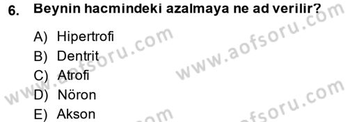 Yaşlı ve Hasta Bakım Hizmetleri Dersi 2014 - 2015 Yılı (Vize) Ara Sınav Soruları 6. Soru
