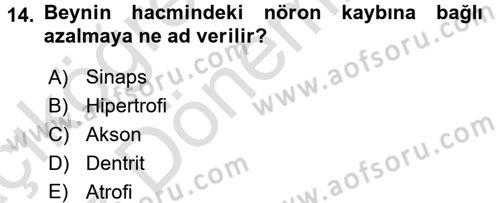 Yaşlı ve Hasta Bakım Hizmetleri Dersi 2016 - 2017 Yılı (Vize) Ara Sınav Soruları 14. Soru
