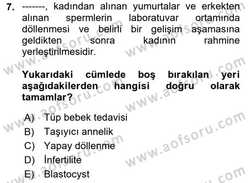 İnsan Davranışı Ve Sosyal Çevre 1 Dersi 2018 - 2019 Yılı (Vize) Ara Sınav Soruları 7. Soru