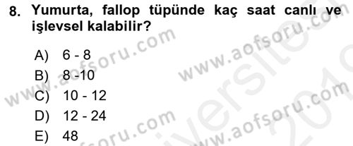 İnsan Davranışı Ve Sosyal Çevre 1 Dersi 2018 - 2019 Yılı (Vize) Ara Sınav Soruları 8. Soru