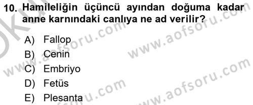 Bakım Elemanı Yetiştirme Ve Geliştirme 2 Dersi 2018 - 2019 Yılı Yaz Okulu Sınav Soruları 10. Soru
