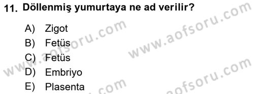 Bakım Elemanı Yetiştirme Ve Geliştirme 2 Dersi 2020 - 2021 Yılı Yaz Okulu Sınav Soruları 11. Soru
