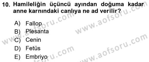 Bakım Elemanı Yetiştirme Ve Geliştirme 2 Dersi 2021 - 2022 Yılı Yaz Okulu Sınav Soruları 10. Soru
