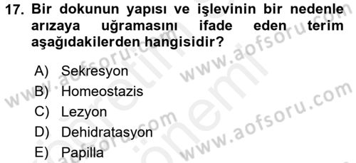 Fiziksel Rehabilitasyon Dersi 2017 - 2018 Yılı (Final) Dönem Sonu Sınav Soruları 17. Soru