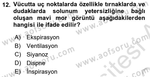 Yaşlı Bakımı İlke Ve Uygulamaları Dersi 2020 - 2021 Yılı Yaz Okulu Sınav Soruları 12. Soru